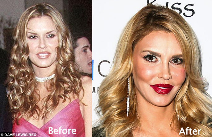 Brandi Glanville's Plastic Surgery Transformation: Before & After Photos