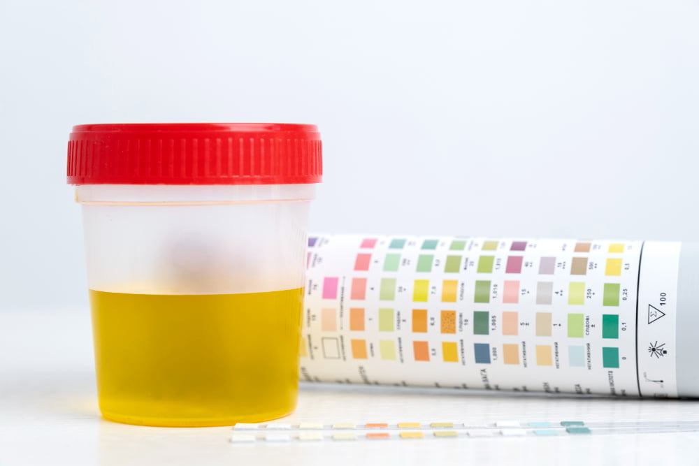 Celsius Energy Drinks & Drug Tests: The Unexpected Truth