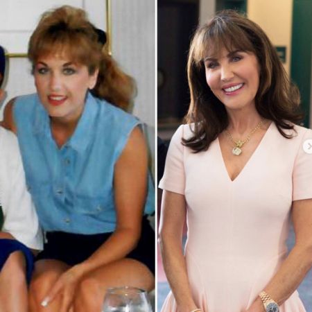 Dr. Phil's Wife: A Before & After Look At Her Plastic Surgery Journey