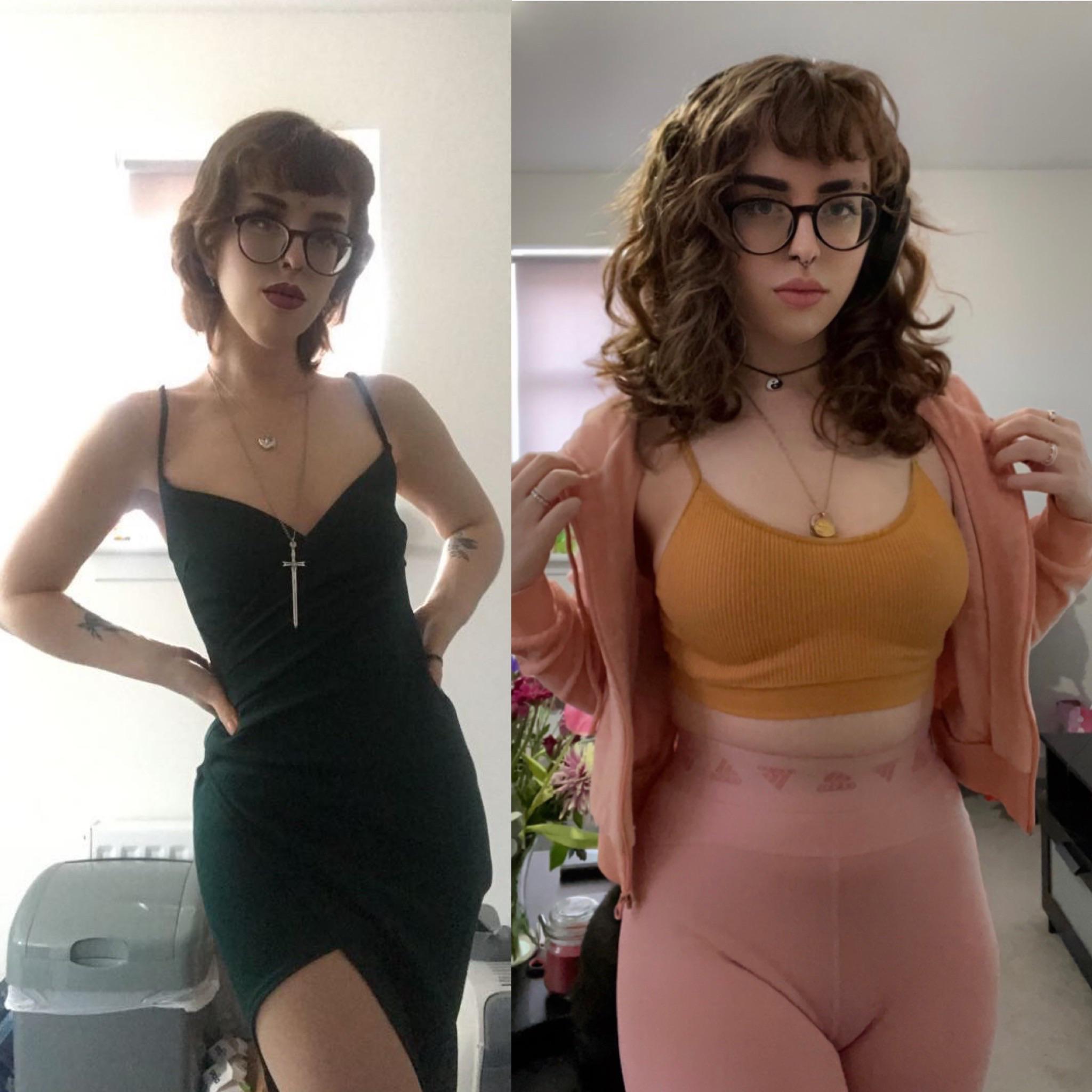 Iranian Redditors Share Their Weight Gain Journeys: Success Stories And Lessons Learned
