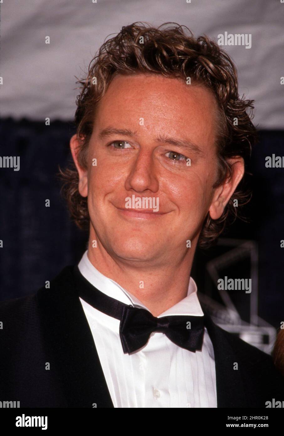 Judge Reinhold's Facelift: A Statistical Analysis Of Celebrity Cosmetic Surgery