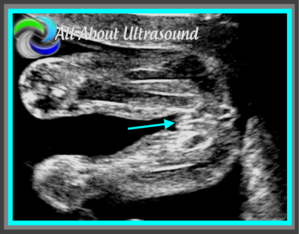 OBGYN Sonographer Jobs: Current Openings & Career Resources
