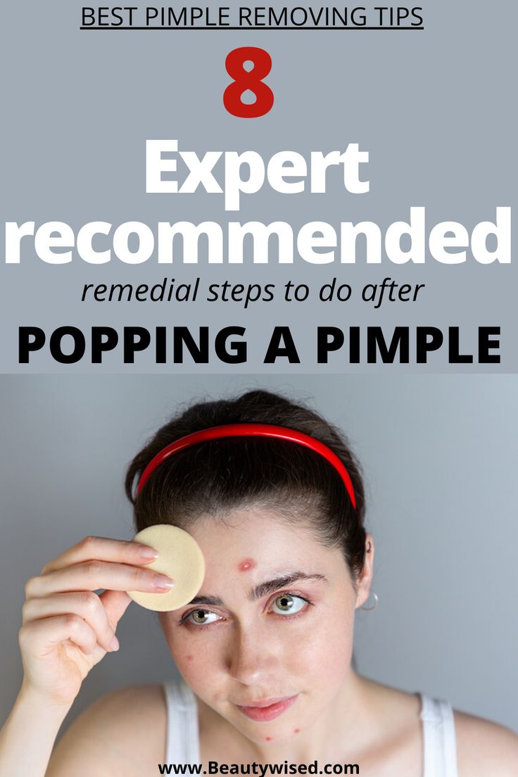 Pimple Popping: A Dermatologist's Guide To Safe And Effective Extraction