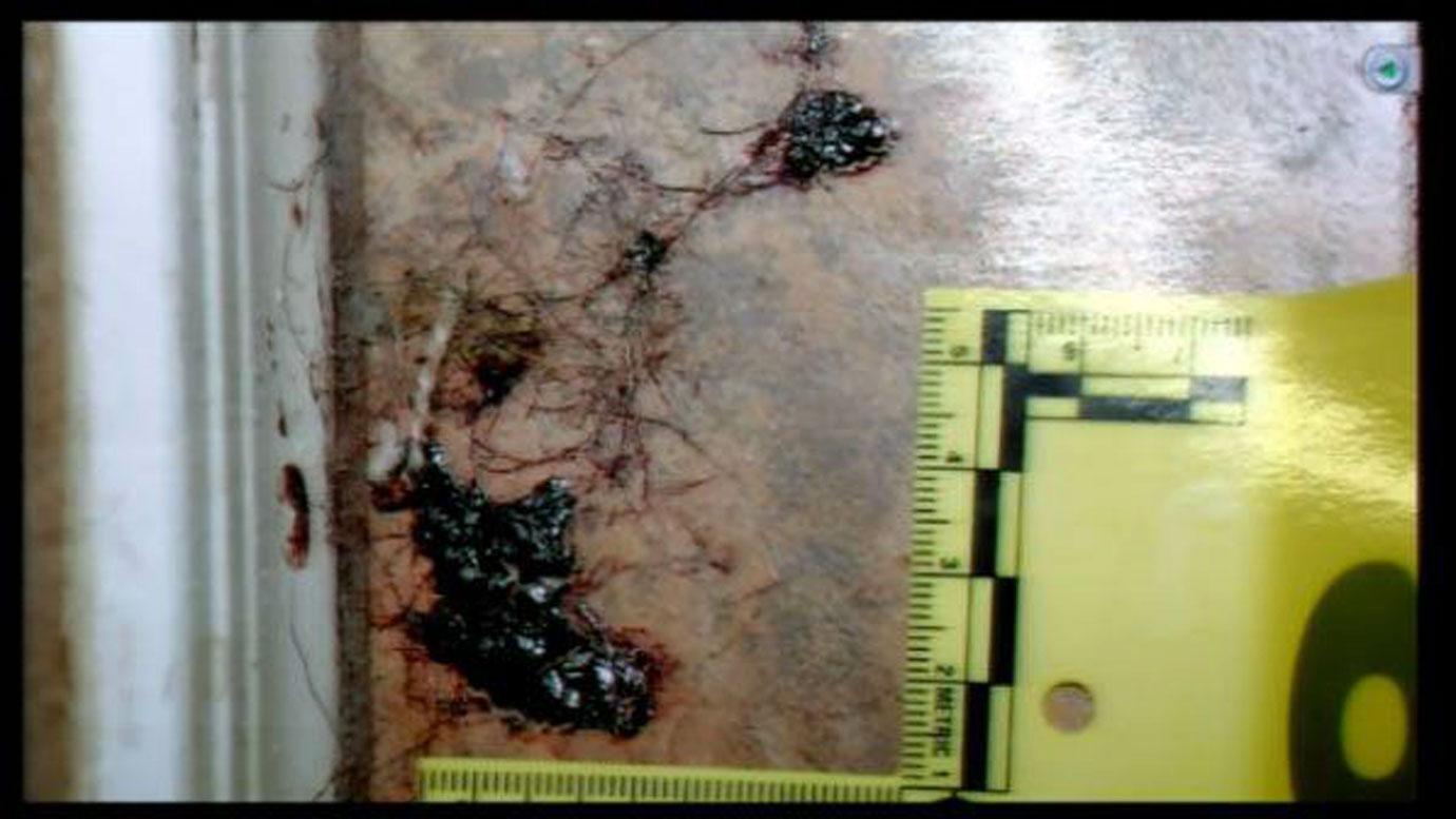 Travis Alexander Autopsy Photos: A Comprehensive Overview