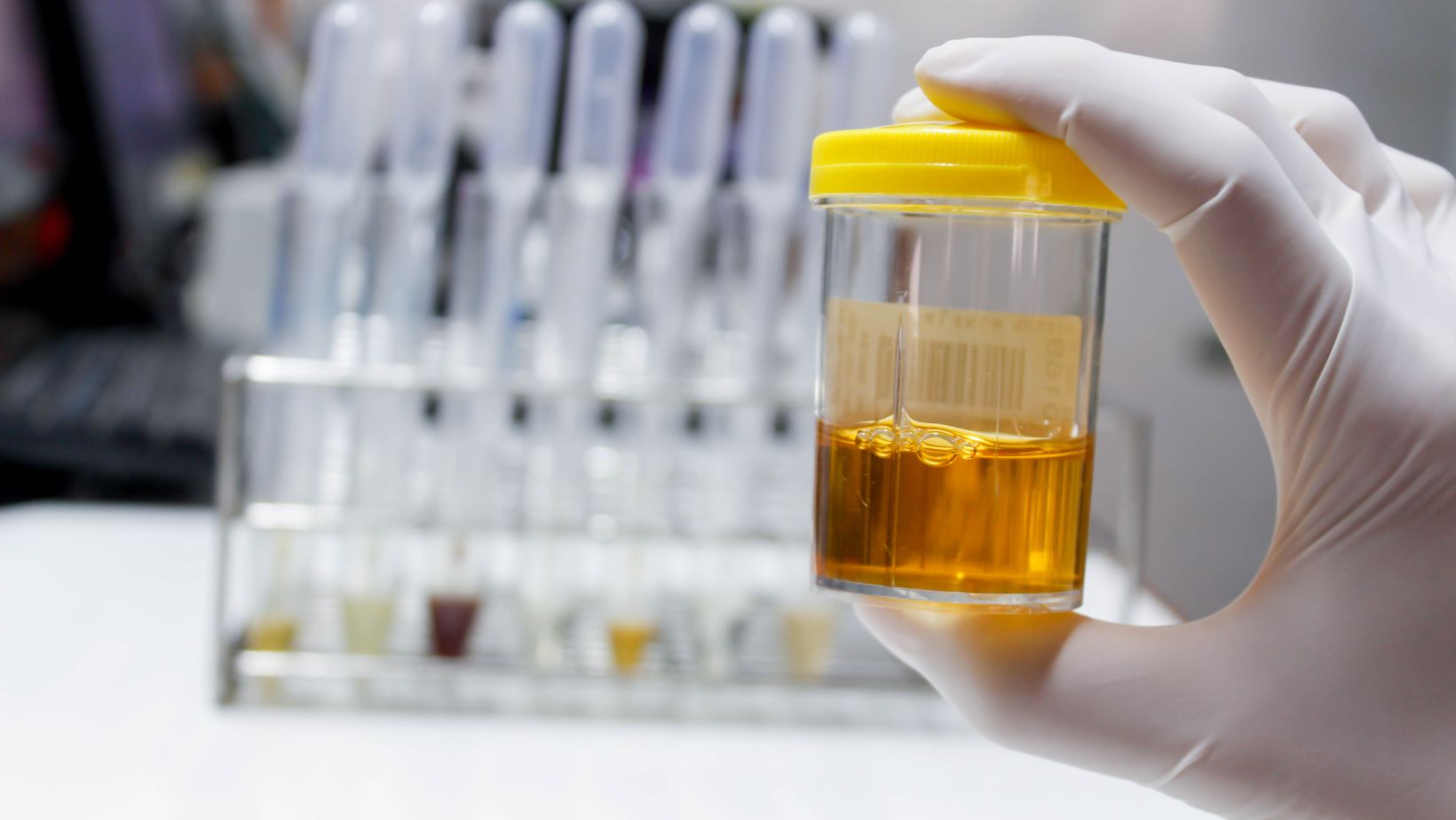 Understanding 35765N Drug Test Results: What You Need To Know